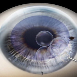 Endothelial Membrane For DMEK